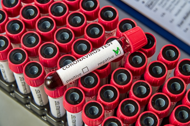 Test tube with negative blood test for COVID-19 on vacuum tubes with blood samples.  