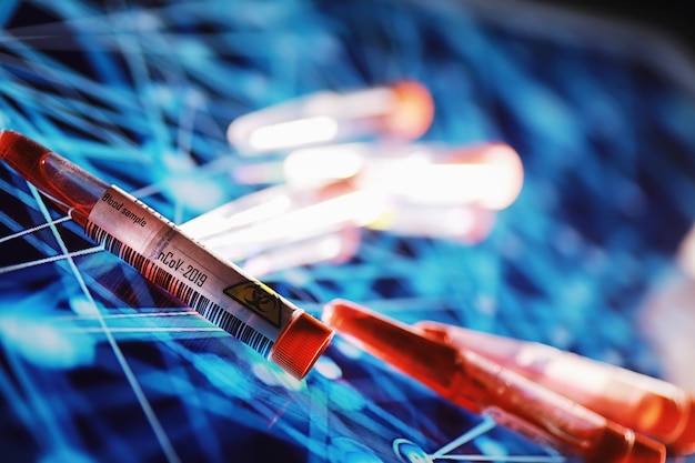 Test tube with patient blood for testing. Analysis for the virus. Coronavirus pandemic laboratory studies. Vaccine development.