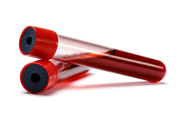 Photo test tube with red plug isolated on white background with clipping path