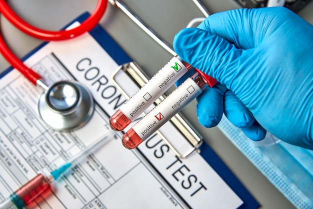 Photo test tubes in the doctor's hand with blood tests for covid-19 on the background of the analysis form.