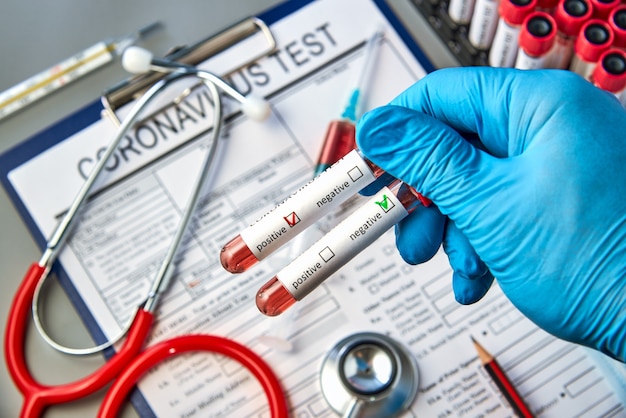 Test tubes in the doctor's hand with blood tests for COVID-19