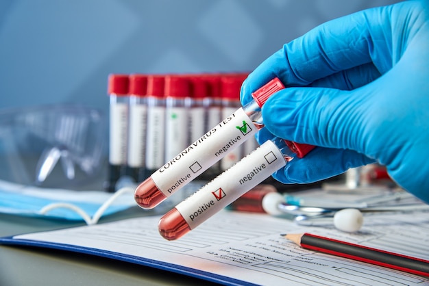 Photo test tubes in the doctor's hand with a positive and negative blood sample for covid-19.