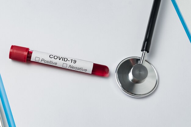Covid-19 분석 및 청진을 위해 혈액으로 튜브를 테스트하십시오. 의료 검진