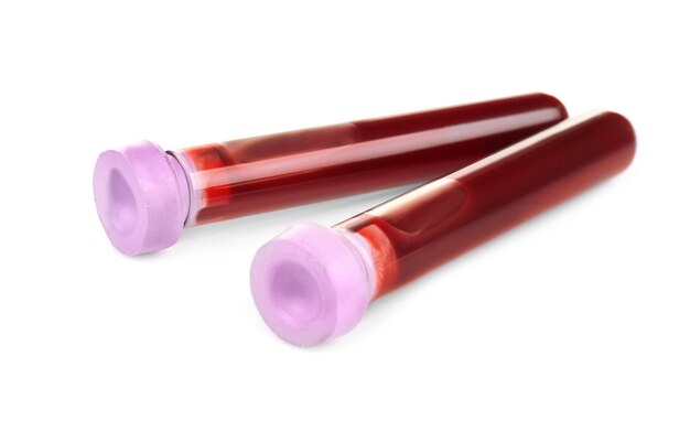 Test tubes with blood isolated on white