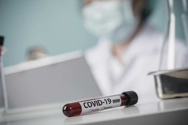 Testing patients blood samples for Coronavirus Outbreak (COVID-19) in the laboratory, New coronavirus 2019-nCoV