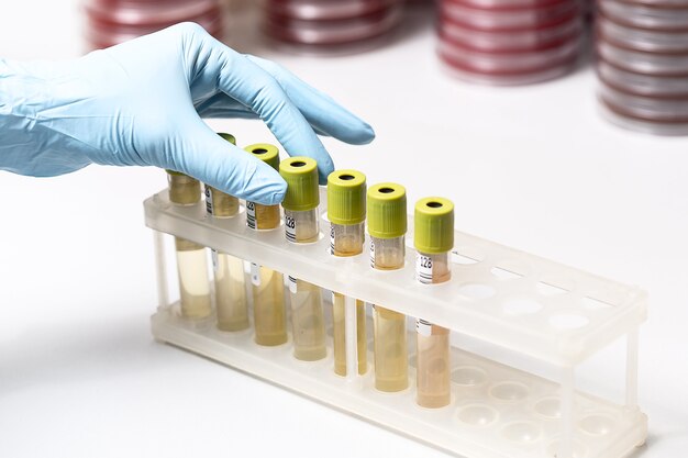 Testtubes with yellow liquid in the laboratory