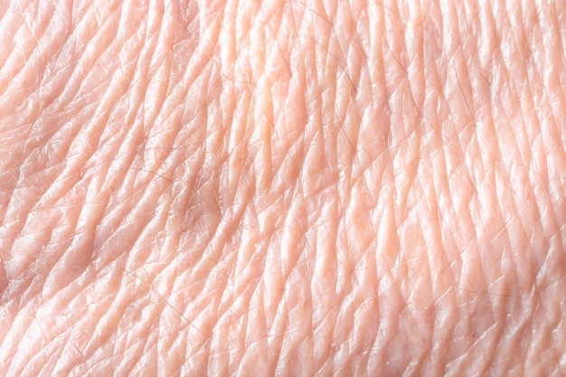 Texture of aging skin close up