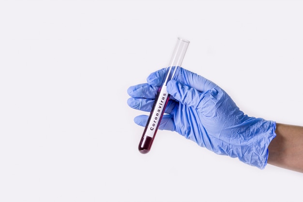 Фото Рука в синей медицинской перчатке держит пробирку с кровью на коронавирусе. эпидемия китайского вируса.