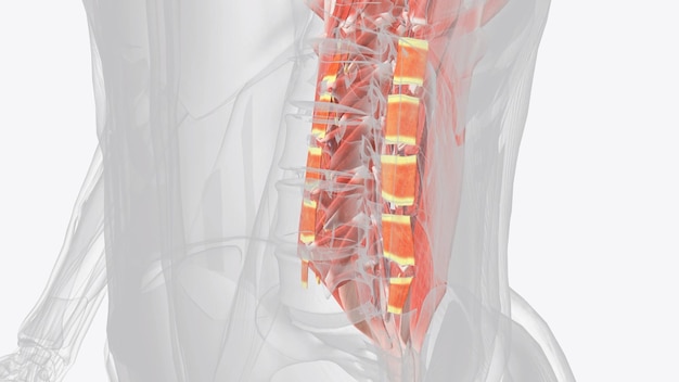 사진 인터트랜스버사리 근육은 인접한 허지 척추의 가로 과정 사이에 붙어 있습니다.
