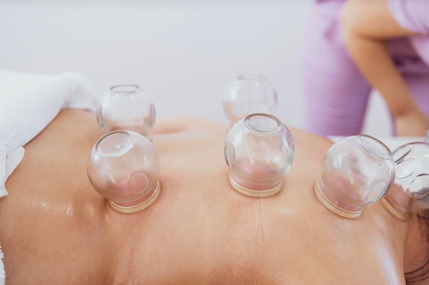 therapist doing hijama treatment on patient back Putting heated vacuum cups to heal chronic pain