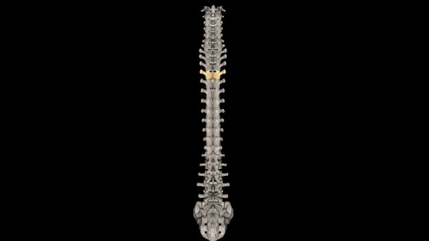 Foto thoracic vertebrale t4