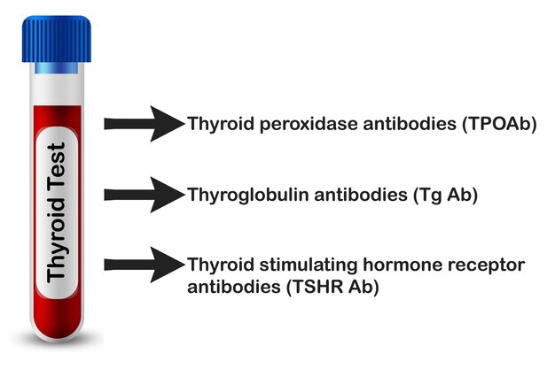 Photo thyroid profile test concept with test