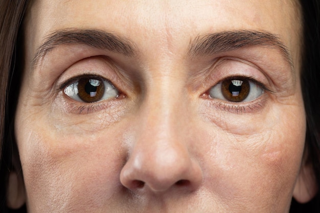 Photo tired eyes of middle aged woman. concepts of aging, cosmetology and health.