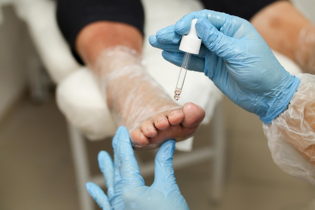 Лечение грибка ногтей на ногах, увлажняющая процедура с маслом. Обертывание ног и ступней лечебными веществами для питания кожи. Фото высокого качества