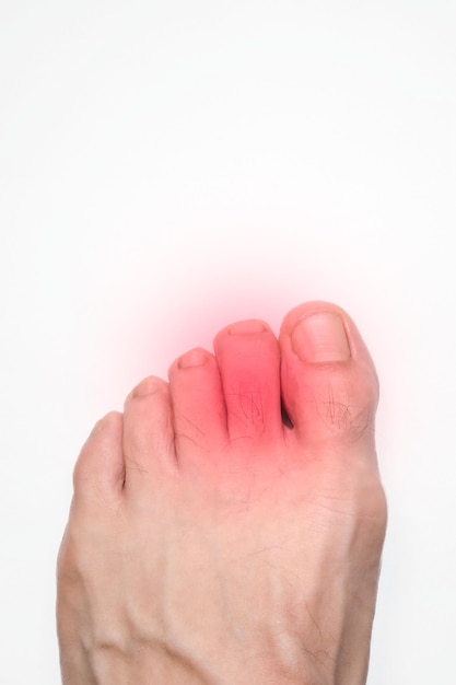 Toes of a persons left foot with a red mark representing pain with space above for text