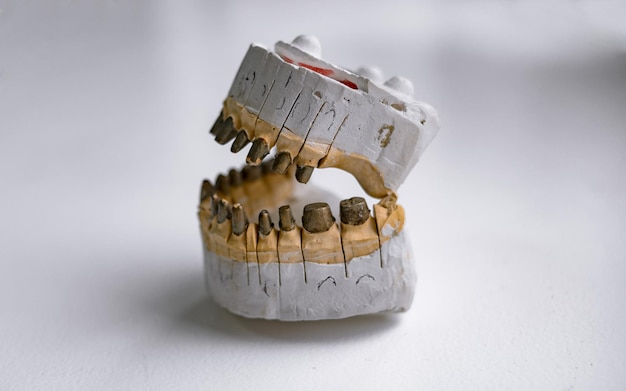 Photo tooth casts for prosthetics