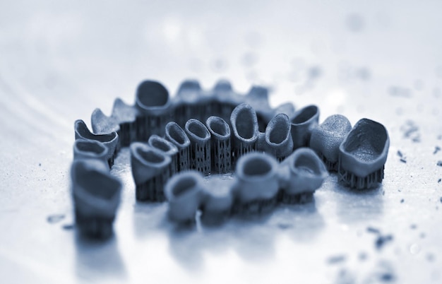 Зубные коронки, созданные на d-принтере по металлу