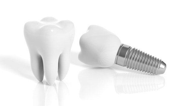 Tooth and dental implant isolated on white background