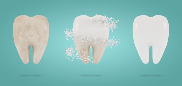 치아 미백. 치아, 치아 건강 및 위생의 치과 검사의 개념. 3D 그림입니다.