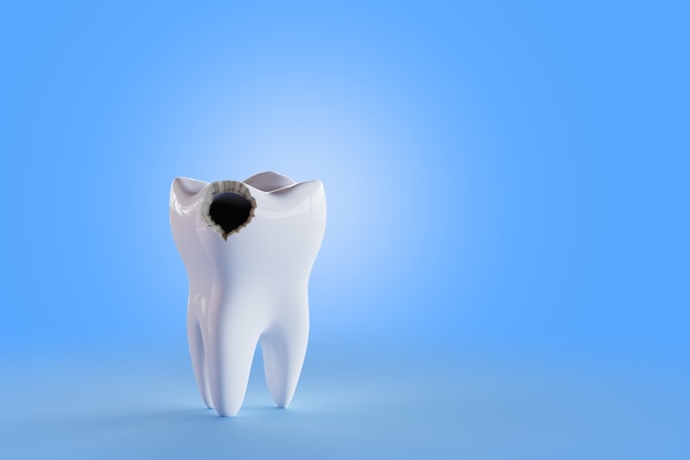 Photo tooth with hole blue background. render 3d illustration