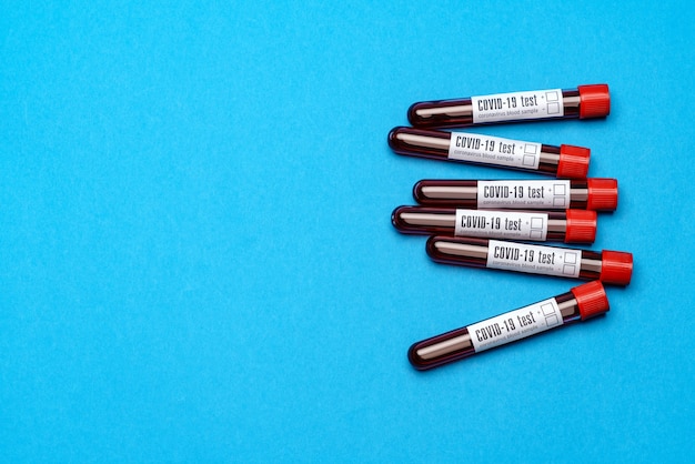 Top view of medicine test tubes with blood samples over blue background.