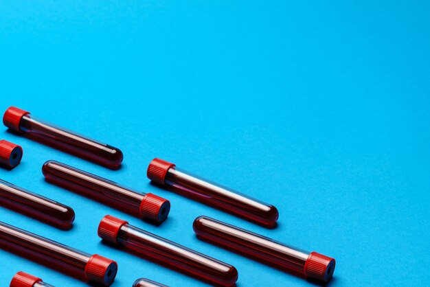 Top view of medicine test tubes with blood samples over blue background.