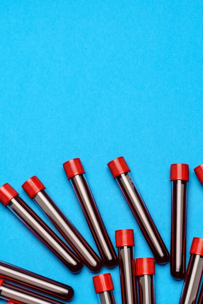 Top view of medicine test tubes with blood samples