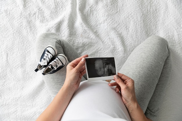 Top view pregnant woman holding an ultrasound picture 