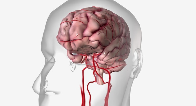 Photo a transient ischemic attack is a mini stroke with similar symptoms to an ischemic stroke but without lasting effects