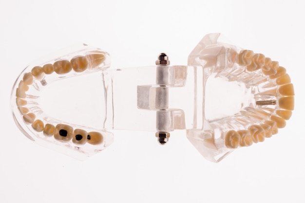 Transparent dentures jaw layout on a white