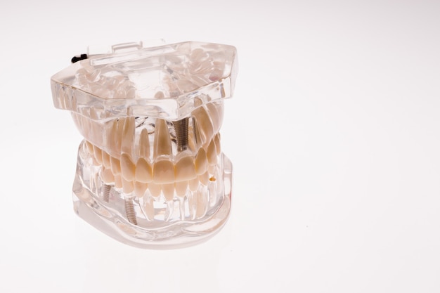 Transparent dentures jaw layout on white