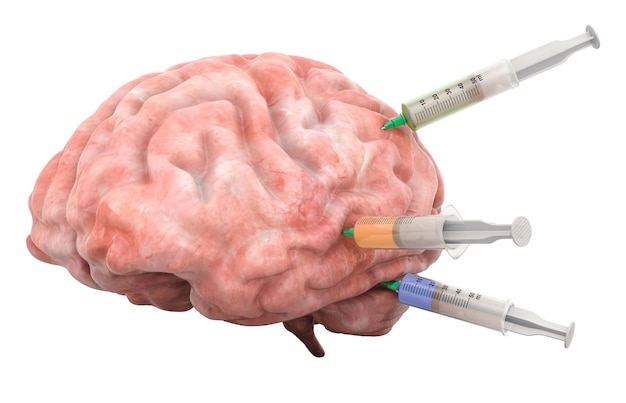 Treatment of Brain Diseases concept 3D rendering