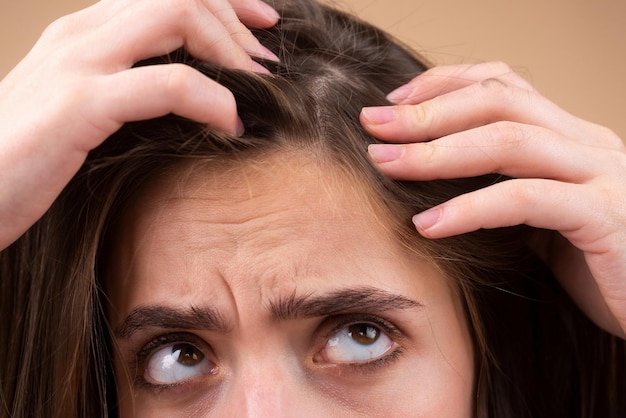 Treurige vrouw met haaruitvalprobleem bezorgd over haaruitval