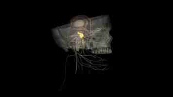 Photo the trigeminal ganglion is located lateral to the cavernous sinus in a depression of the temporal bone