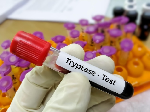 Tryptase test. A Tryptase test can help doctors determine if a severe allergic reaction, ANAPHYLAXIS