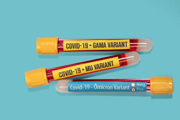 Tubes with blood and labels of covid19 and gamma mu and omicron variants isolated