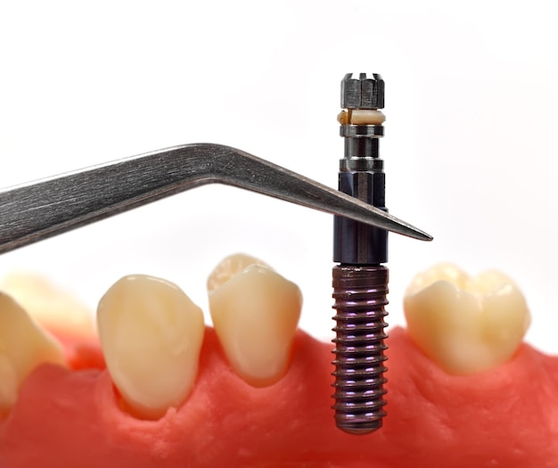 Tweezers with dental implant