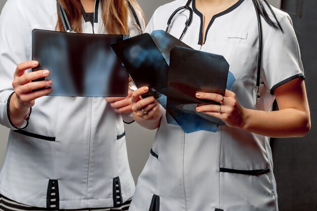 Two orthopedist female doctors hold in their hands some x-rays and examine them.