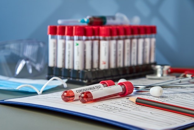 Two test tubes with blood samples for COVID-19 coronavirus