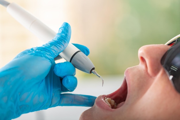 Ultrasone tandenreiniging close-up Verwijdering van tandplak Paradontitis paradantoz Tandheelkunde gezonde tanden mooie glimlach