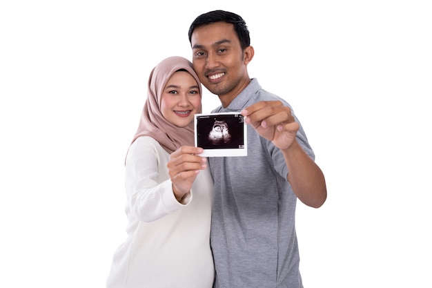 Ultrasound image couple on camera