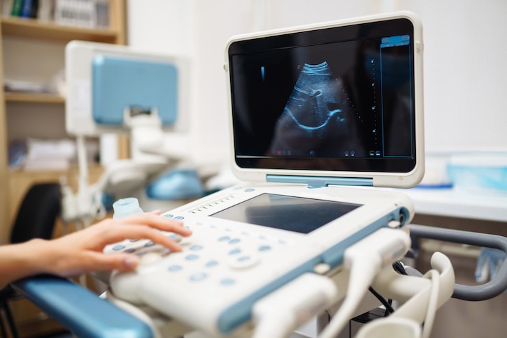 Photo ultrasound machine in the doctors office in the clinic diagnostics sonography pregnancy