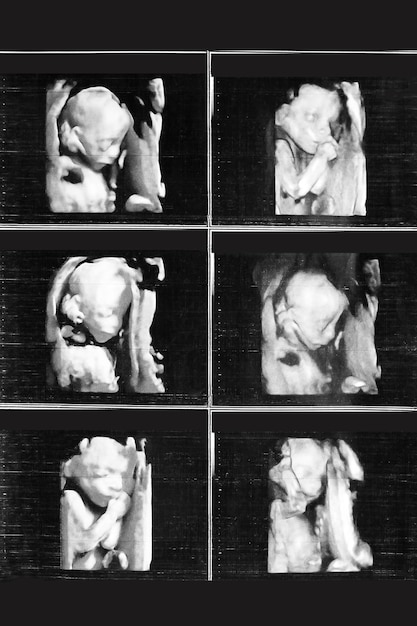 Ultrasound picture baby memory photography