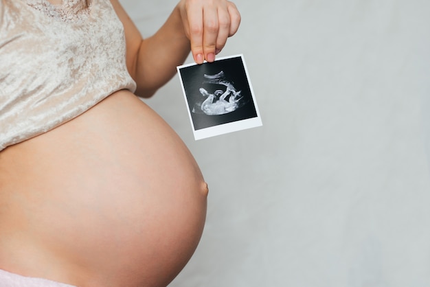 Immagine ad ultrasuoni nelle mani di una ragazza incinta