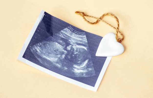 ultrasound picture and a white ceramic heart on light orange background sonogram of fetus unborn