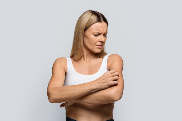 unhappy woman scratching her itching hand copy space