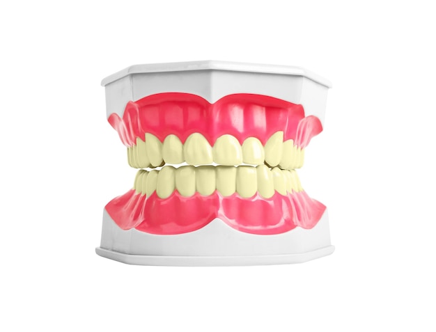 Unhealthy bad teeth of yellow color with caries dental disease Jaw model with bad enamel