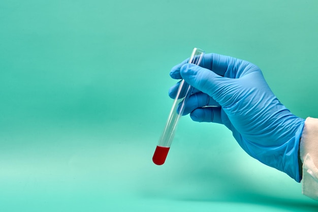 Photo unrecognizable doctor holding test tube with blood