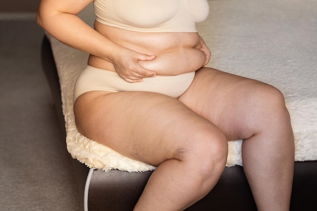 Cropped Image Of Overweight Fat Woman Tummy, Losing Weight, Excess Fat In  Yellow Underwear. Hiding Flabs Cellulite. Diet Stock Photo, Picture and  Royalty Free Image. Image 183614048.