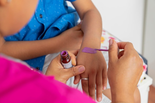 Unrecognizable female doctor placing a bandage on a child who injured his arm closeup of hands doing a cure